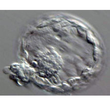 Embryo Donation Program 1
