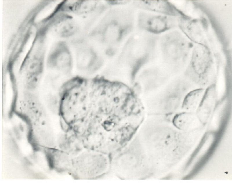 Embryo Freezing IVF Procedure Family Fertility Center PA