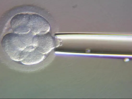 Embryo Split